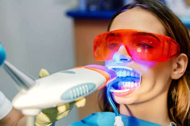 Simplifying Teeth Whitening: A Comprehensive Guide Basingstoke