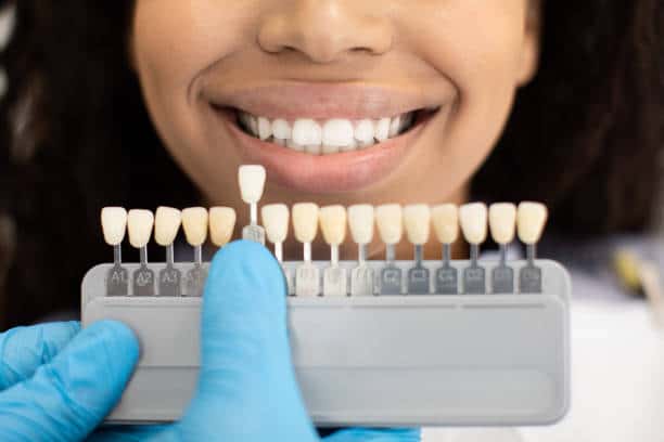 Laser Teeth Whitening: Exploring the Longevity of Your Brighter Smile Basingstoke