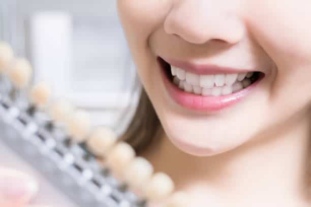 Teeth Whitening Kings Norton Basingstoke