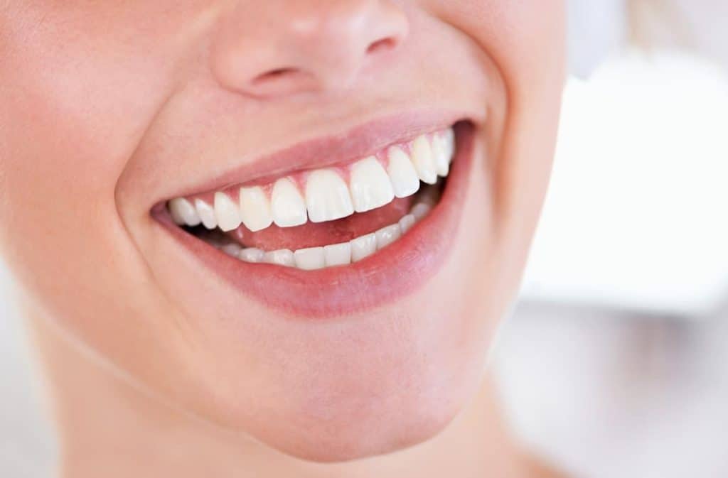 Teeth Whitening West Drayton Basingstoke